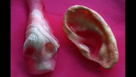 Nose and ear molds made of nanocomposite material seeded with cells in a cell solution.