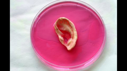 An ear mold in a cell solution.