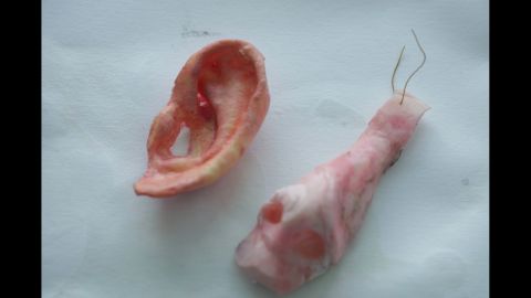 Nose and ear molds.