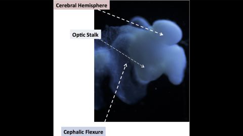 This lab-grown "mini brain" includes most characteristic of a human fetal brain including an optic stalk and a bend in the mid-brain region. (Click to expand.)