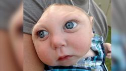 jaxon buell baby without skull