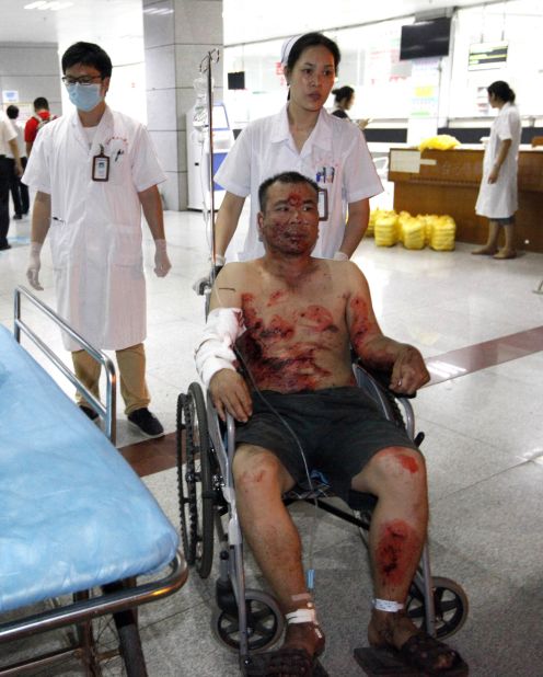 An injured man is given treatment at a hospital. 
