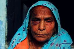 Asghari Begum sits broken and bruised after Monday's mob attack.