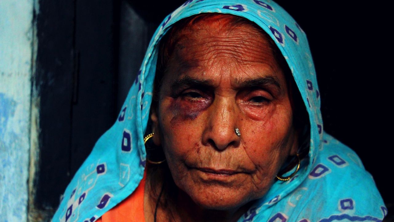 Asghari Begum sits broken and bruised after Monday's mob attack.