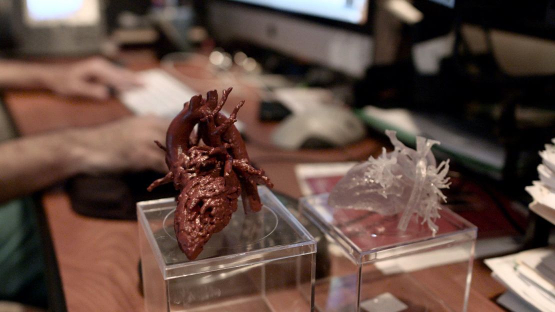 How 3D Printer Heart Technology Changed a Teen's Life