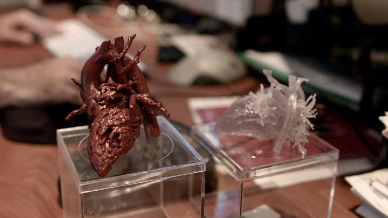 Mia's surgeon carried around a model of the girl's heart for weeks.