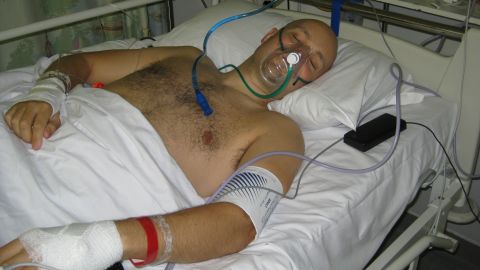 Mark spent 16 months recovering in the intensive care unit after his fall from a second-story window in London in the summer of 2010. The accident left him paralyzed from the waist down.