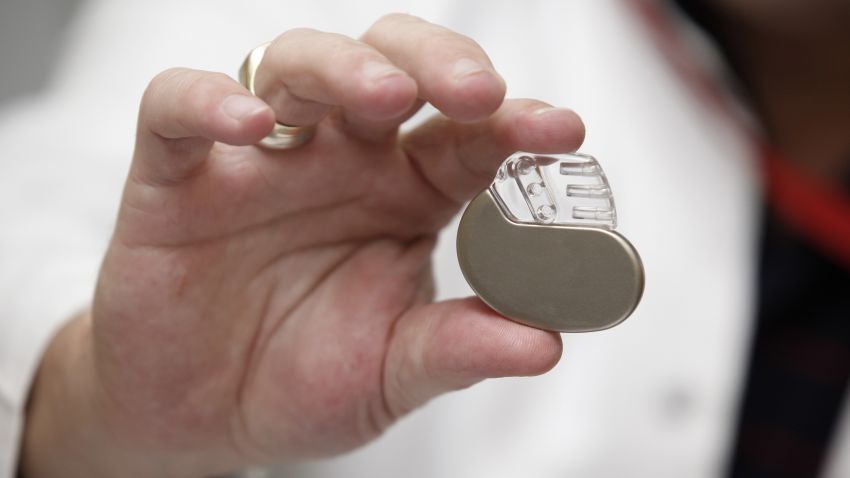 The first pacemakers were developed in the 1930's. They were large machines that were handcranked! Researchers worked on making smaller devices, and in 1958, the first human implanted device was created -- but it only lasted three hours. The pacemaker as we know it today wasn't achieved until the development of silicone transistors to improve the size of the machine, as well as the development of the long-life lithium battery. Today, packemakers are about the size of a coin.