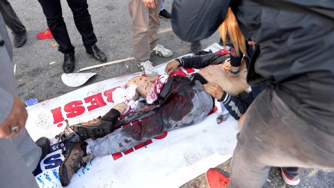 A wounded man is treated at the site of the explosion.