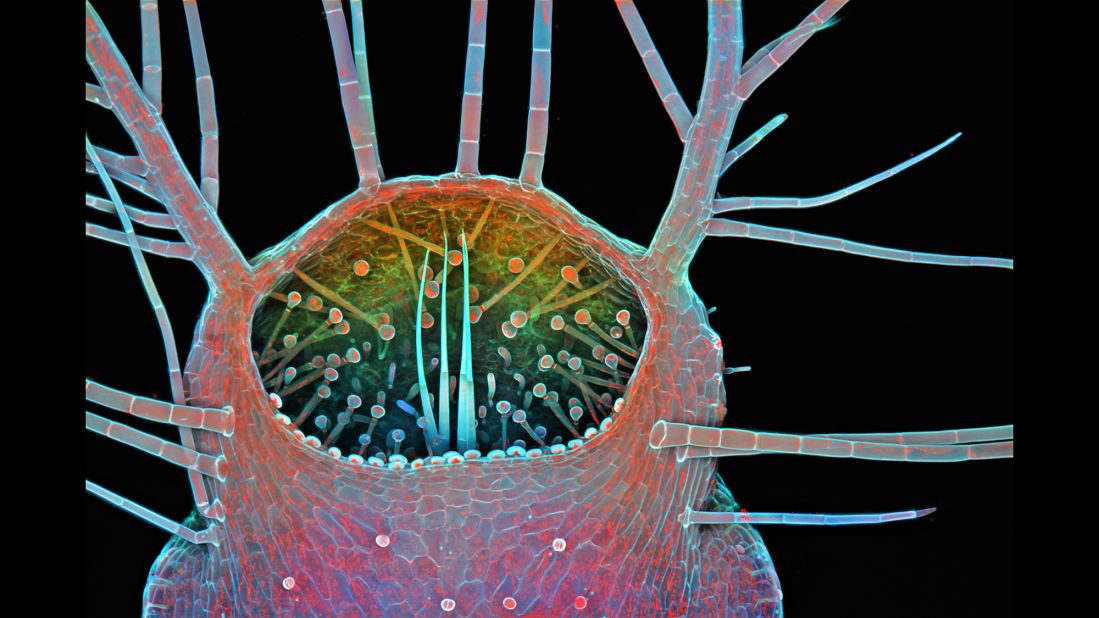 A photo showing the intake of a humped bladderwort (Utricularia gibba), a freshwater carnivorous plant, taken at the Howard Hughes Medical Institute, Janelia Research Campus, Leonardo Lab in Ashburn, Virginia.
