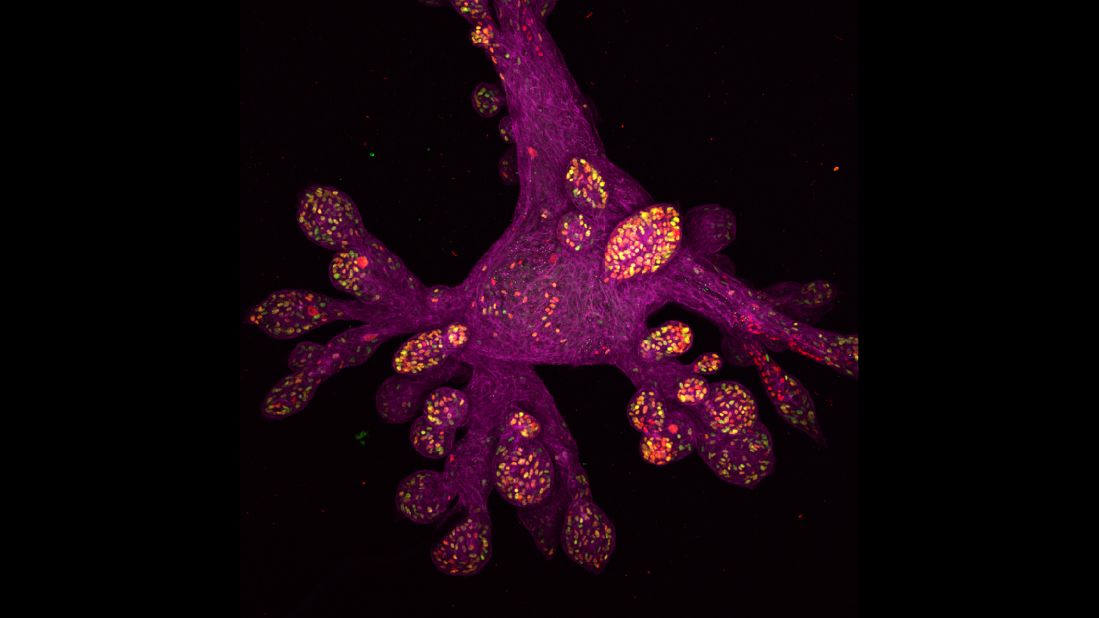 A photo of a lab-grown human mammary gland organoid, taken at the Whitehead Institute for Biomedical Research, Massachusetts Institute of Technology Department of Biology in Cambridge, Massachusetts.