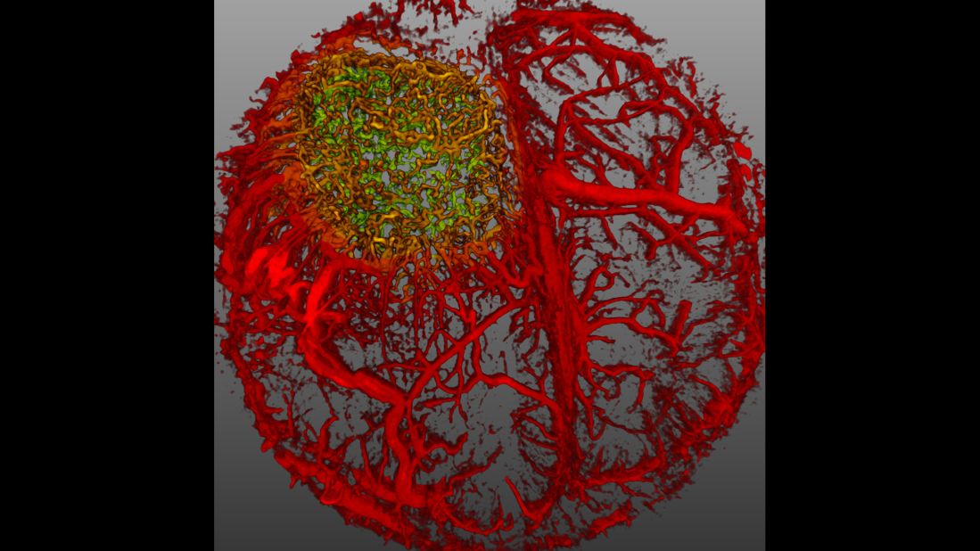 Live imaging of perfused vasculature in a mouse brain with glioblastoma taken at Harvard Medical School, Massachusetts General Hospital, Edwin L. Steele Laboratory for Tumor Biology in Boston.