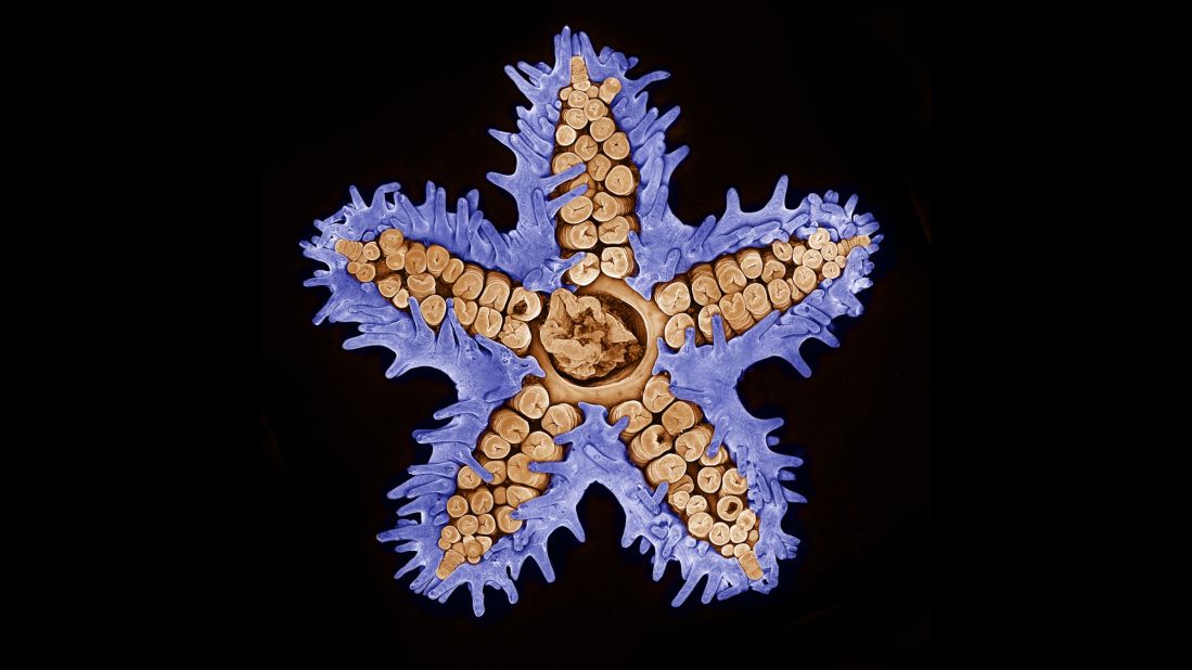 A starfish imaged using confocal microscopy. Image produced at the Memorial Sloan Kettering Cancer Center in New York City.