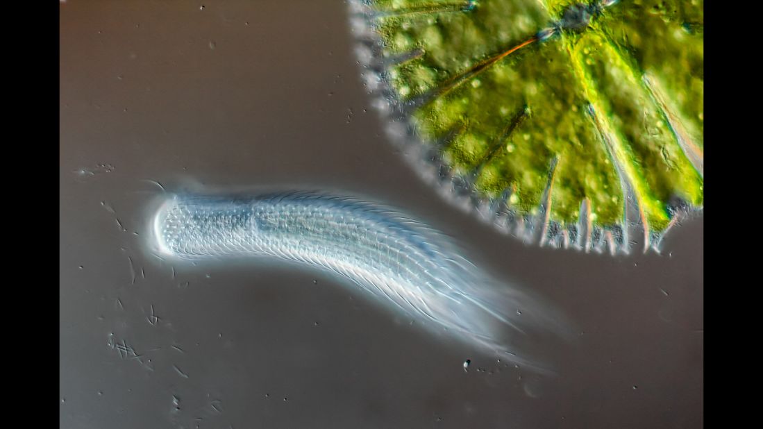 Hairyback worm (Chaetonotus sp.) and algae (Micrasterias sp.), seen under a microscope. Photo taken in Gruenen, Bern in Switzerland.