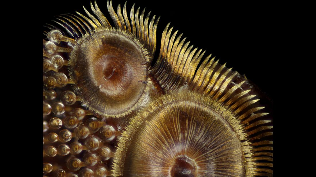 Photo of suction cups on a diving beetle (Dytiscus sp.) foreleg, taken at the Nassau Community College, Department of Biology in Garden City, New York.