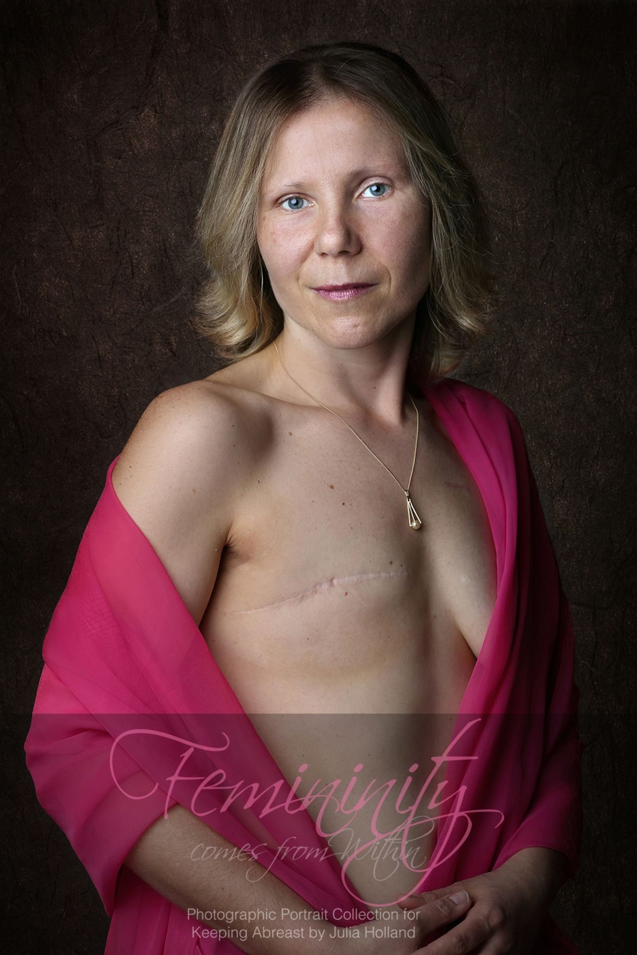 Rebecca lost her right breast to cancer. She chose not to have breast reconstruction at this time.