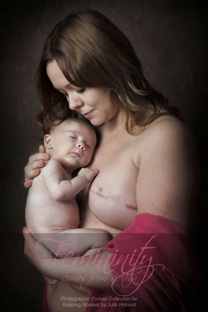 Charlene decided to remove her breasts to avoid cancer. She poses with her daughter after breast reconstruction surgery. 
