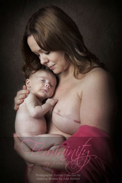 Charlene decided to remove her breasts to avoid cancer. She poses with her daughter after breast reconstruction surgery. 