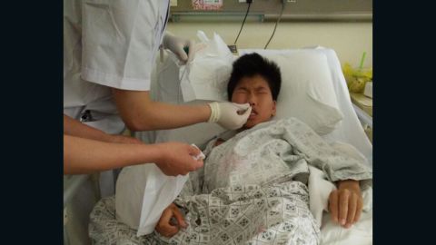 Huang Tanghong, 15, receives treatment at Fujian Provincial hospital on June 26, 2015.