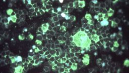 Microscopic scenes - 003Virology - Immunofluorescent techniqueRespiratory syncytial virus, indirect.1977Dr. Craig LyerlaBox 2.5, 4214-77THerpesviridae Infections; Herpes Simplex; DNA Virus Infections
