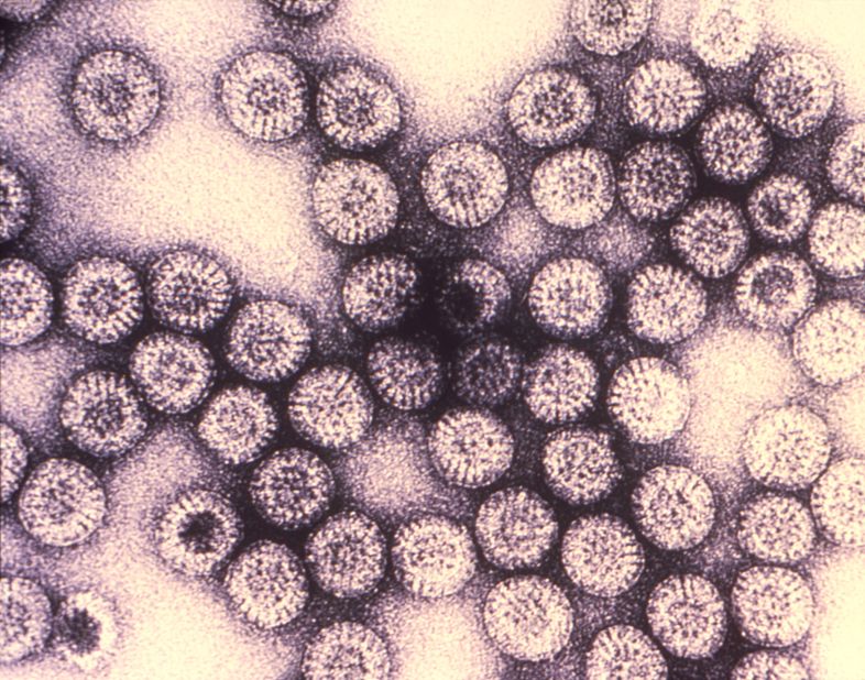 Symptoms of rotavirus include severe, watery diarrhea, often with vomiting, fever and abdominal pain, <a href="http://www.cdc.gov/vaccines/vpd-vac/rotavirus/default.htm?s_cid=cs_074" target="_blank" target="_blank">according to the CDC</a>. There are two rotavirus vaccines available in the United States for infants. 