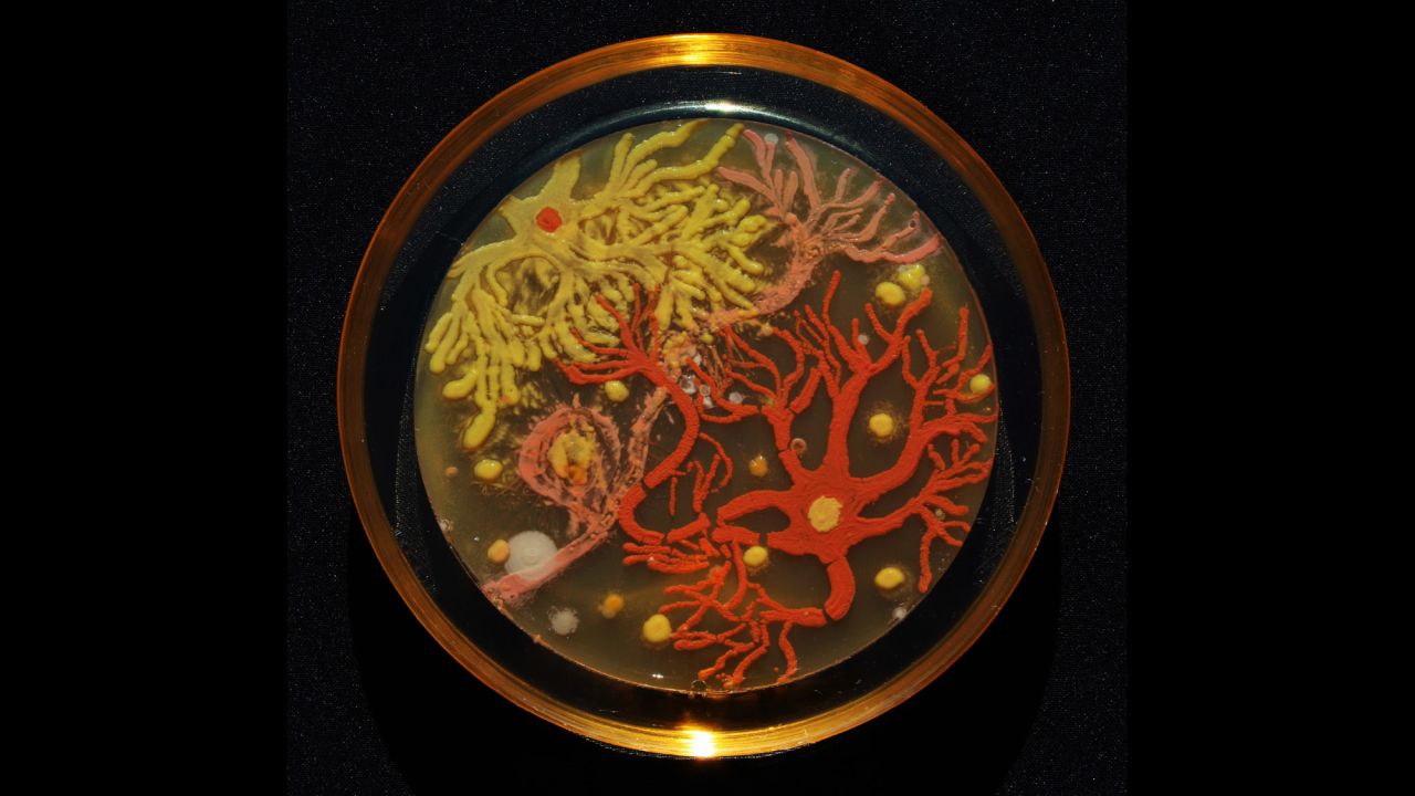 "Neurons" is the first place winner of the Agar Art Contest. It took two days for the bacteria to grow and take form.