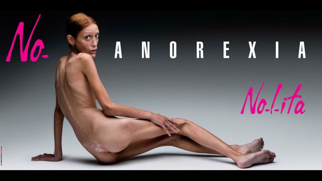 Called "No Anorexia", the 2007 campaign shot by Italian photographer Oliviero Toscani for fashion label Nolita, tackled an extremely challenging subject head on. Backed by the Italian ministry of health, the photo that launched during Milan fashion week and ran in newspapers and on billboards showed a young woman who had fallen victim to the disease. Despite the power behind the ad and the awareness it helped to raise within the fashion industry, the model, Isabelle Caro, tragically died in November 2010. She had made various television appearances and spoken openly about her decision to take part in the campaign. According to an article in the New York Times published after the model's death, Caro had said: "The ideas was to shock people into awareness, I decided to do it to warn girls about the danger of diets and fashion commandments." Not everyone agreed with the approach however and the ad was eventually banned by the Italian advertising watchdog organization for agency. <br />