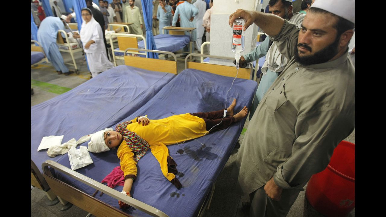 A injured girl lies on a bed at a hospital in Peshawar.