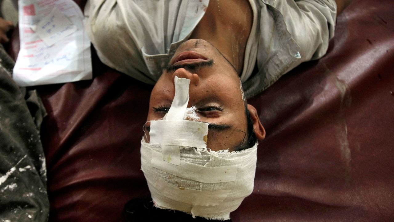 A man injured in the earthquake lies on a bed at a hospital in Peshawar.