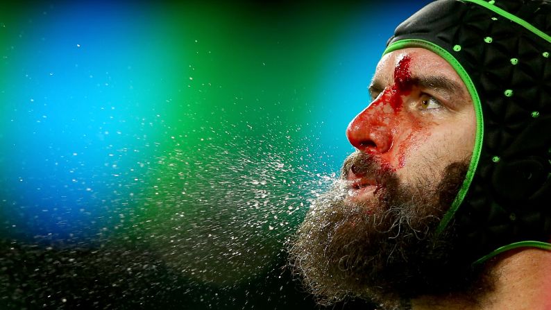 A bloodied Scott Fardy of Australia spits during the 2015 Rugby World Cup Semi Final match between Argentina and Australia at Twickenham Stadium in London on Sunday, October 25. Australia will compete against New Zealand in the <a href="index.php?page=&url=http%3A%2F%2Fbleacherreport.com%2Farticles%2F2582562-rugby-world-cup-final-2015-bold-predictions-for-new-zealand-vs-australia" target="_blank" target="_blank">Rugby World Cup final</a>.