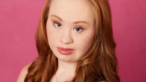 Rosanne: "I created a Madeline Stuart Facebook page and within a week her photos were viral."