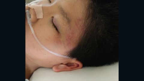 Huang undergoes treatment at the hospital.
