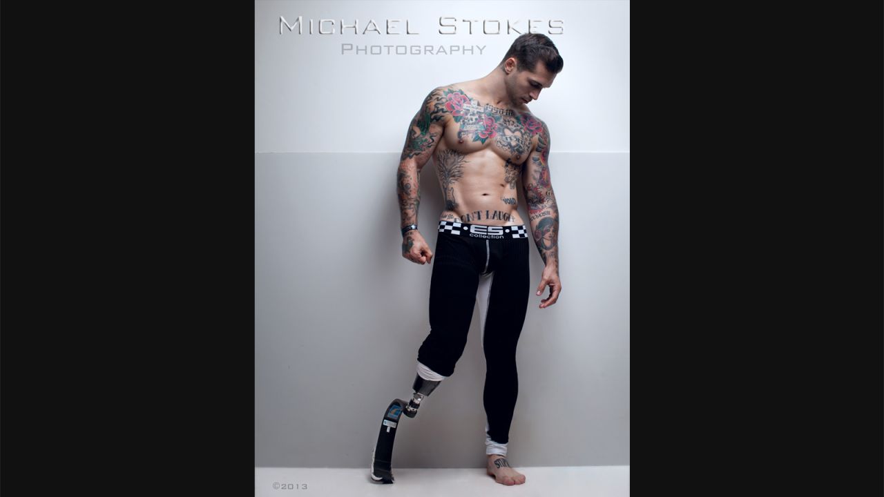 Alex Minsky, a Marine, survived a 47-day coma, a broken jaw and the loss of an arm and a leg. <br /><br />"If I am always smiling and laughing and happy, I attract people who are the same way," Minsky said. "I am so grateful to be alive today."