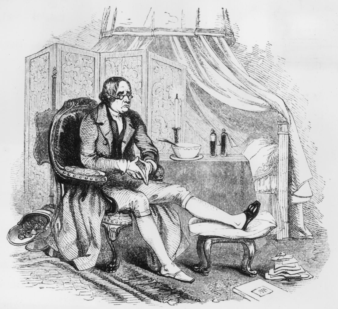 Circa 1800, a  man rests his foot, with his slipper slit to accommodate a foot swollen from gout.  