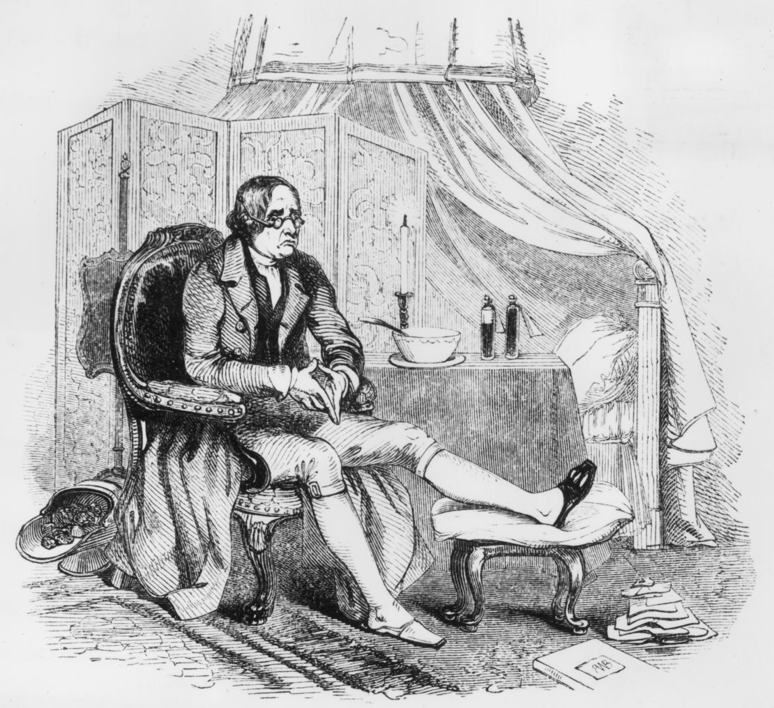 Circa 1800, a man rests his foot, with his slipper slit to accommodate a foot swollen from gout.