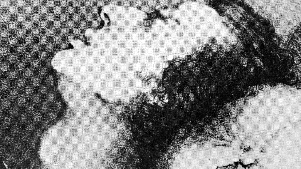 A drawing of composer Frederic Chopin dying from tuberculosis, 1849. 