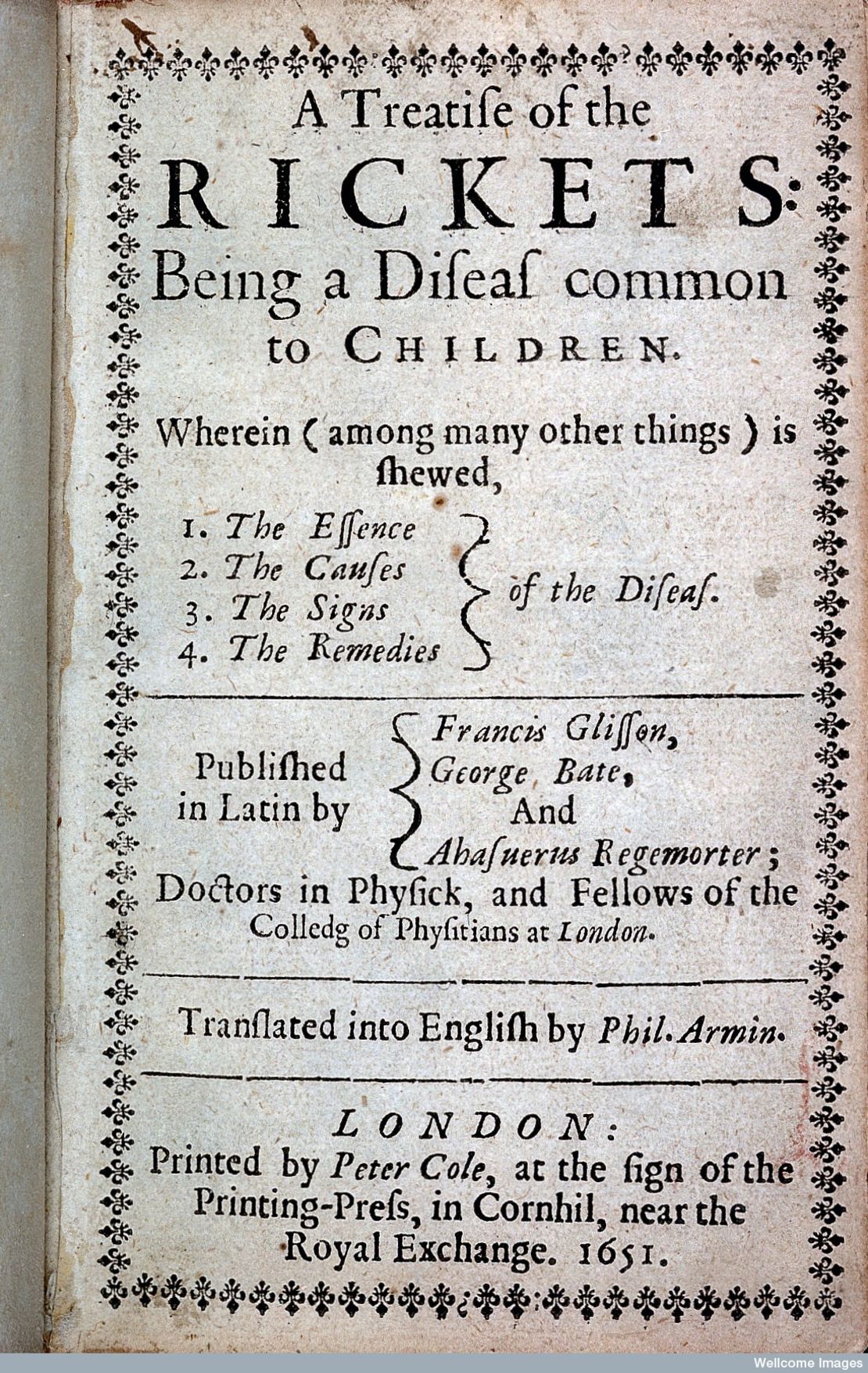 "A treatise of the Rickets," published 1651.