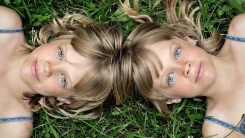 The irises in all four of these eyes are unique from the others.