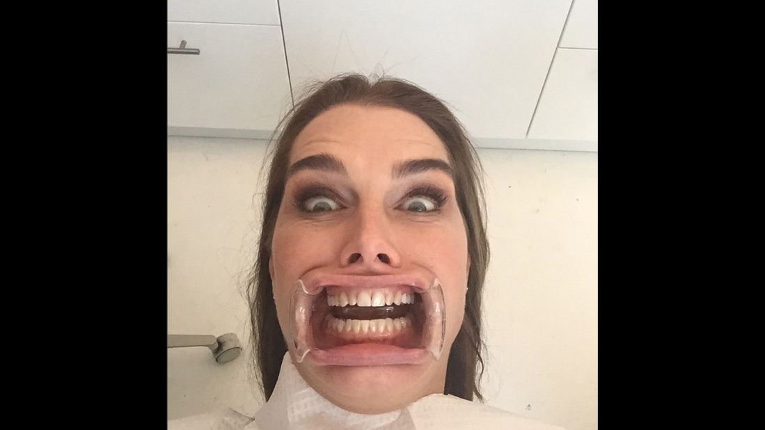 "My new head shot," joked actress Brooke Shields in this selfie she took at the dentist's office and <a href="http://instagram.com/p/yNCV3HTdcO/?modal=true" target="_blank" target="_blank">posted to Instagram</a> on Friday, January 23.