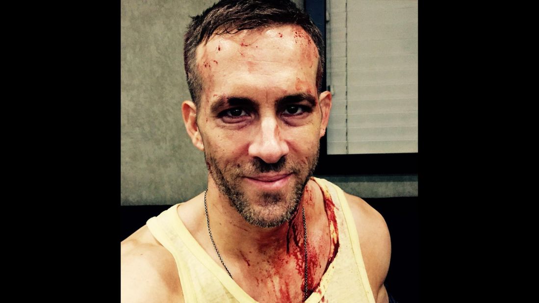 "Officially halfway through production on #deadpool and I feel fine. The other guys? Notsomuch," actor Ryan Reynolds <a href="https://twitter.com/VancityReynolds/status/591900470790135808" target="_blank" target="_blank">tweeted</a> on Saturday, April 25. 