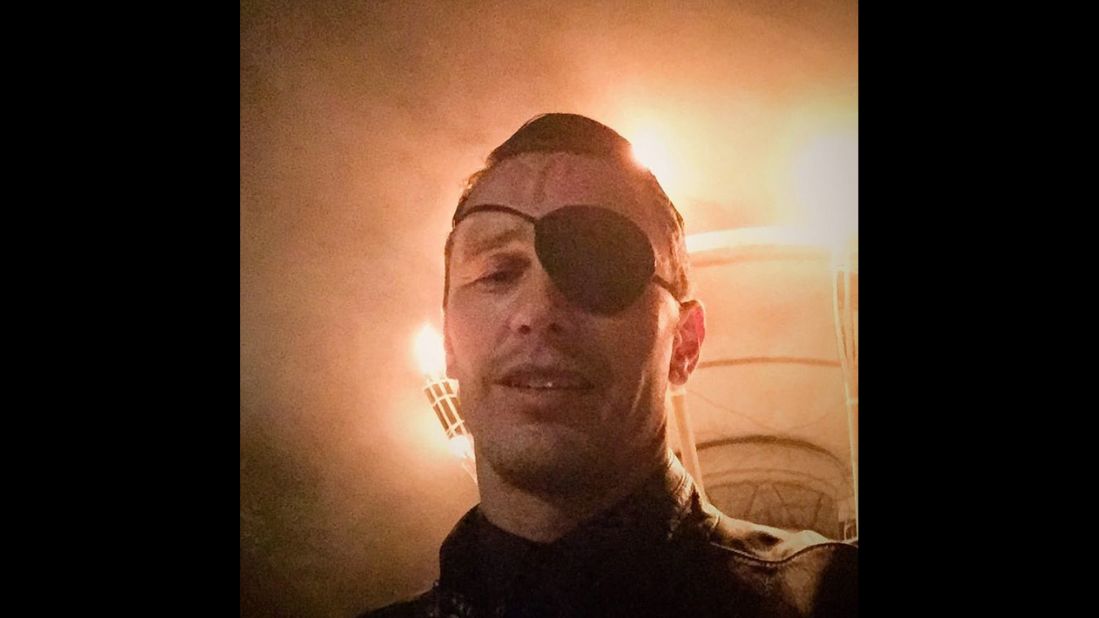 Actor James Franco wears an eye patch on Monday, July 27. <a href="https://instagram.com/p/5pNgiKy9bA/" target="_blank" target="_blank">He posted it to Instagram</a> with the caption, "When you're out on the town and your INNER PIRATE starts swingin' his sword."