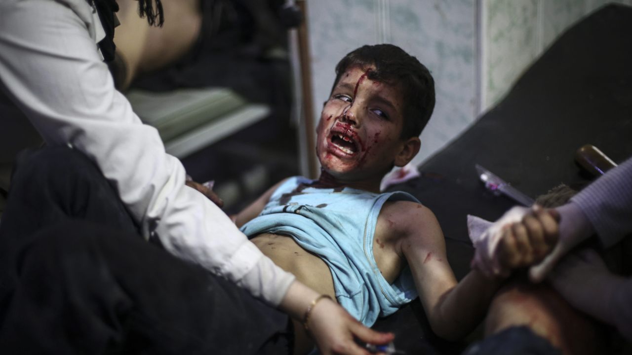 <strong>October 30: </strong>A boy receives first aid at a field hospital after a reported airstrike in the rebel-held area of Douma, Syria. Local activists said the airstrike came from forces loyal to the regime of President Bashar al-Assad. <a href="http://www.cnn.com/2015/04/17/middleeast/syria-civil-war-by-the-numbers/" target="_blank">More than 300,000 people have been killed in Syria</a> since civil war began in April 2011.