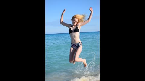 Eleven months after her first stem cell treatment, Sarah jumped for joy on the beach in Cancun. Her wish was to see a beautiful beach before dying; now, she visits to celebrate the success of her treatment. 