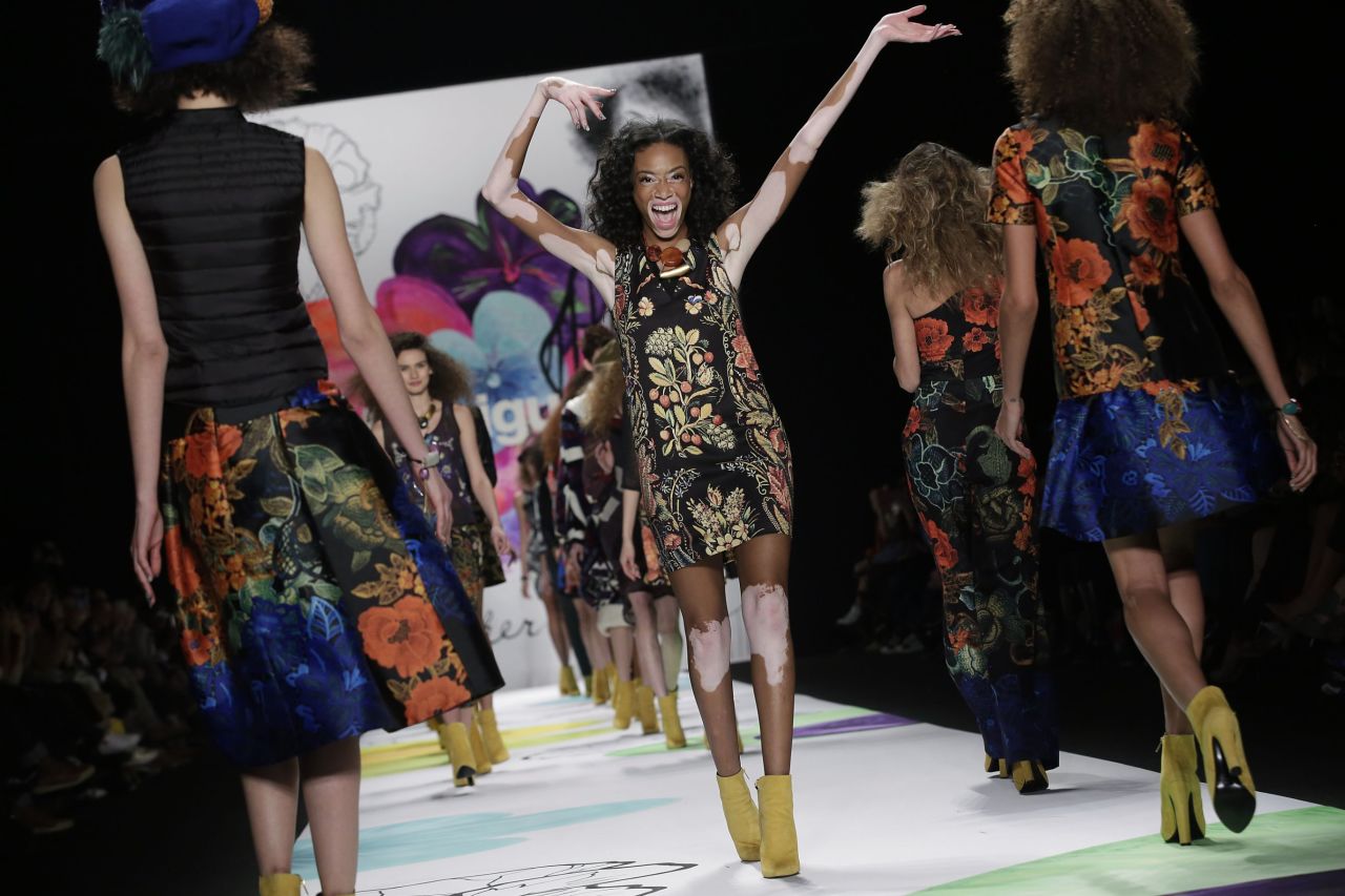 Winnie Harlow has walked runways at New York, London and Paris fashion weeks, but doesn't want her popularity to be a mere flash in the pan, acknowledging that whilst "the industry is opening up, [it] still needs to accept various forms of beauty as a standard, as opposed to an occurrence now and then."