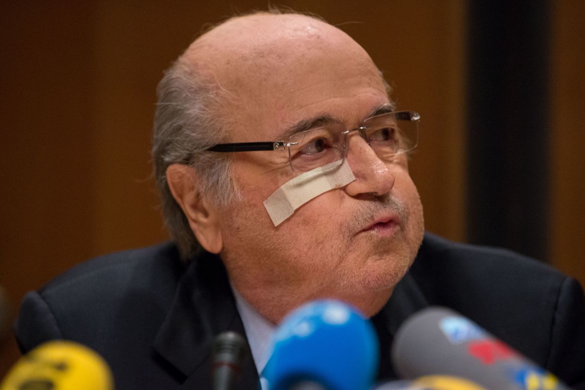 FIFA president Joseph S. Blatter during a press conference he convened in response to the ban imposed by FIFA's Ethics Committee. The Swiss was sporting a band aid under his right eye -- thought to be because of a recent mole removal.