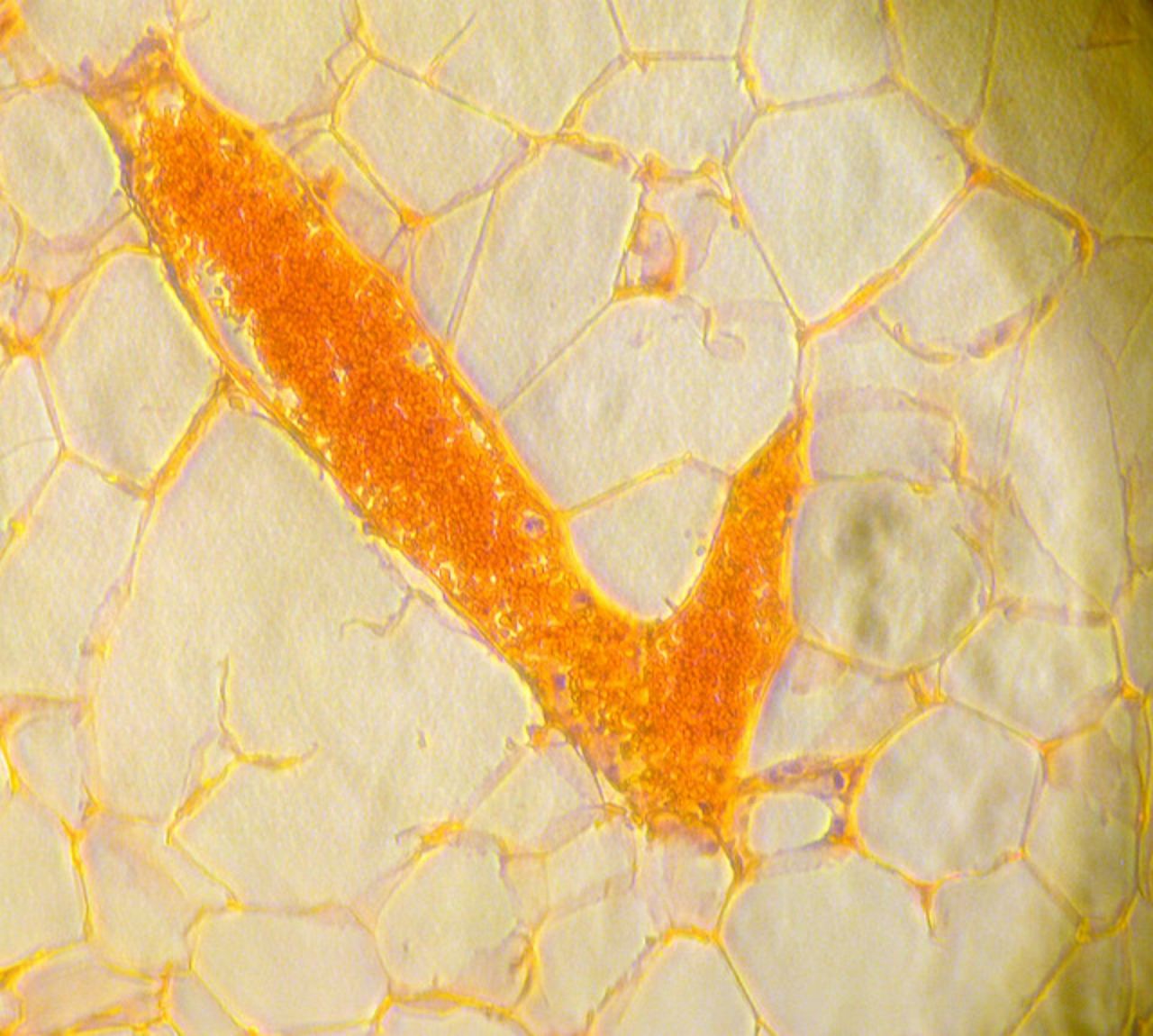 There are two forms of fat cells -- brown and white. The white cells store energy (fat)  so it's ready for release when needed whereas brown cells burn energy to create heat and keep the body warm. Pictured, the white blood cells of a mouse with a blood vessel running through the center.