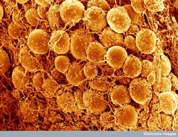 High calorie diets lead to more deposits of fat cells, pictured, mainly consisting of white fat cells. When greater levels of white fat are stored inside the the body, the higher the levels of this blocking protein, reducing the ability of brown fat cells to burn energy.