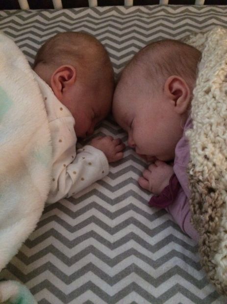 Doctors in Minnesota thought there was no operation available to save Teegan (left) and sent her home to die.