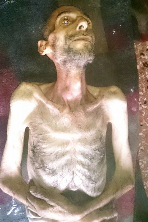 One activist in the Syrian town of Madaya posted this image on social media of Suleiman Abdul-Karim Fares, 40, who had died from starvation on January 4, 2016. CNN cannot independently verify the image or information.