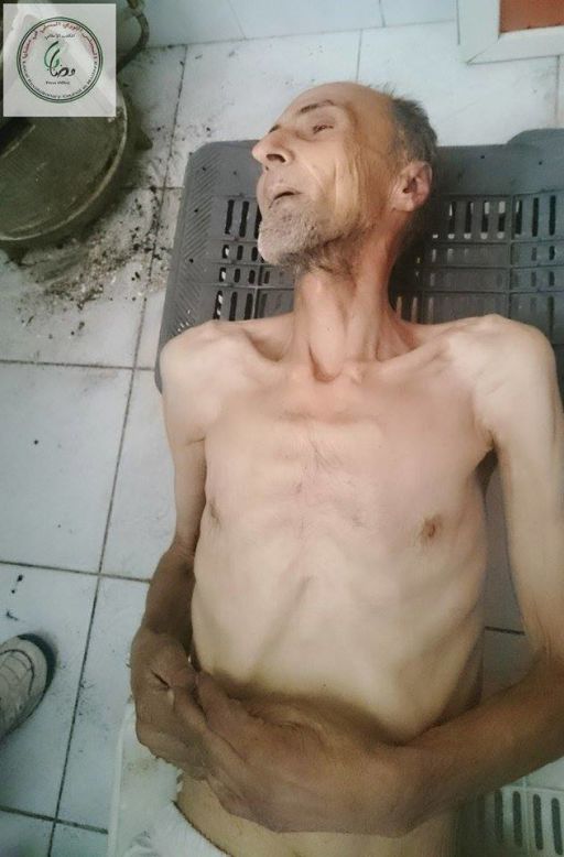 One activist in the Syrian town of Madaya posted this image on social media of Abdel Karim Jawad, 60, who had died on January 2, 2016 due to starvation and lack of access to medication. CNN cannot independently verify the image or information.